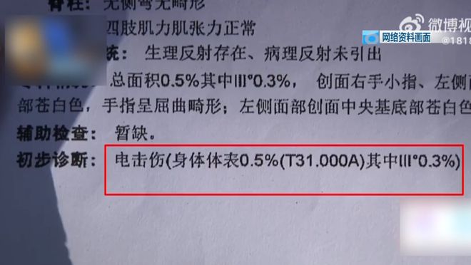 岁儿童爬空调外机瞬间晕厥！米乐m6肌腱都打断了！5(图2)